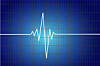 Heartbeat graph