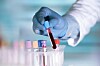 blood sample