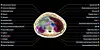 A processed image of the midsection of a human body scanned by the Midjourney Scanner