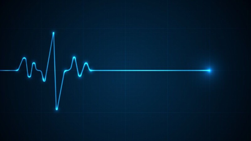 Cardiac monitor maker's security skips a beat as data thieves go for the jugular
